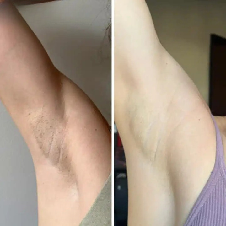 Gel Exfoliante Aclarante