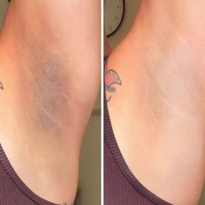 Gel Exfoliante Aclarante